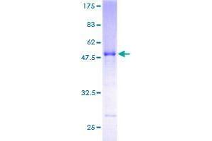 RAB, Member of RAS Oncogene Family-Like 3 (RABL3) (AA 1-236) protein (GST tag)