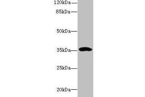 Western blot All lanes: CCDC24 antibody at 6 μg/mL + MCF-7 whole cell lysate Secondary Goat polyclonal to rabbit IgG at 1/10000 dilution Predicted band size: 35, 31 kDa Observed band size: 35 kDa
