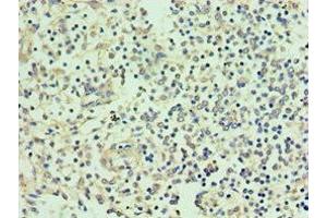 Immunohistochemistry of paraffin-embedded human spleen tissue using ABIN7155522 at dilution of 1:100 (SMYD1 antibody  (AA 1-350))