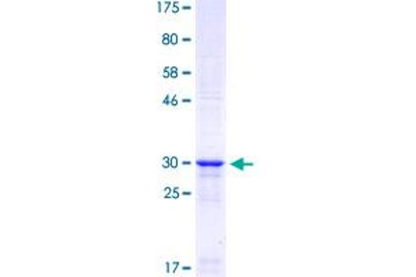 NR2F2 Protein (AA 283-342) (GST tag)
