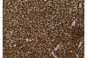 ABIN6272267 at 1/100 staining Mouse spleen tissue by IHC-P.