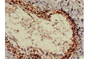 Immunohistochemistry of paraffin-embedded human lung tissue using ABIN7167768 at dilution of 1:100 (ALDH1A2 antibody  (AA 1-518))