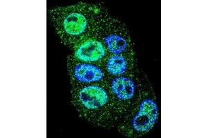 Confocal immunofluorescent analysis of INHBA Antibody (N-term)(Cat#AP52211PU-N) with HepG2 cell followed by Alexa Fluor 488-conjugated goat anti-rabbit lgG (green). (INHBA antibody  (N-Term))