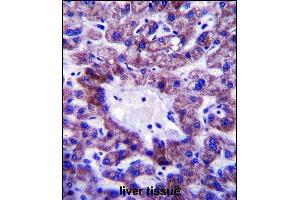 C5orf33 Antibody (Center) (ABIN657726 and ABIN2846712) immunohistochemistry analysis in formalin fixed and paraffin embedded human liver tissue followed by peroxidase conjugation of the secondary antibody and DAB staining. (NADK2 antibody  (AA 122-150))