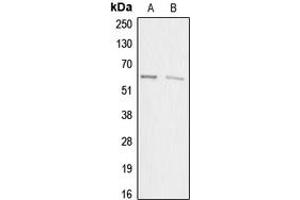 Western blot analysis of ACRBP expression in HEK293T (A), HeLa (B) whole cell lysates. (ACRBP antibody  (Center))