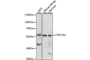 Western blot analysis of extracts of various cell lines, using CYP27 antibody (982) at 1:1000 dilution. (CYP27A1 antibody  (AA 200-400))