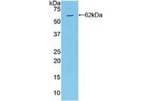 Detection of Recombinant MAP2K4, Human using Polyclonal Antibody to Mitogen Activated Protein Kinase Kinase 4 (MAP2K4) (MAP2K4 antibody  (AA 137-394))