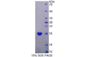 SDS-PAGE (SDS) image for Trafficking Protein Particle Complex 2 (TRAPPC2) (AA 1-140) protein (His tag) (ABIN4989550)