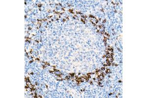 Immunohistochemistry of paraffin-embedded Human tonsil using IGHD antibody (ABIN7267824) at dilution of 1:100 (40x lens). (IgD antibody)