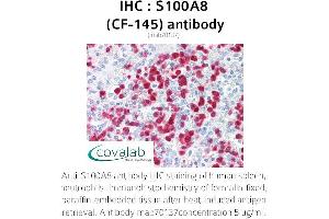 Image no. 1 for anti-S100 Calcium Binding Protein A8 (S100A8) antibody (ABIN1723086) (S100A8 antibody)