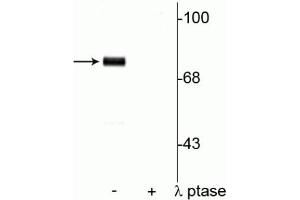 Western blot of rat cortical lysate showing specific immunolabeling of  the ~78 kDa synapsin I phosphorylated at Ser9 in the first lane (-). (SYN1 antibody  (pSer9))