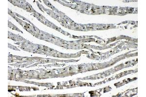 IHC analysis of Cytoglobin using anti- Cytoglobin antibody .