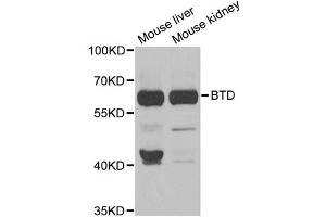 Western blot analysis of extracts of various cell lines, using BTD antibody (ABIN5973709) at 1/1000 dilution. (BTD antibody)