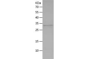 Myosin 9 (MYH9) (AA 2-241) protein (His tag)