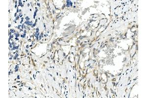 IHC analysis of CDR2 using anti-CDR2 antibody (ABIN7599397).