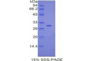 SDS-PAGE analysis of Rabbit CETP Protein.
