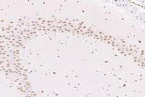 Immunohistochemistry analysis of paraffin-embedded mouse substantia nigra using NUP133 (ABIN7074909) at dilution of 1: 4800 (NUP133 antibody)