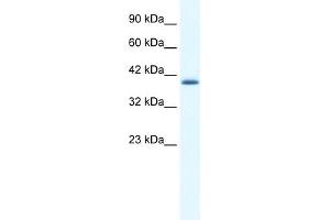 WB Suggested Antibody Titration:  0. (ZNF365 antibody  (N-Term))