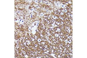 Immunohistochemistry of paraffin-embedded mouse spinal cord using CNTN1 antibody (ABIN7266492) at dilution of 1:100 (40x lens). (Contactin 1 antibody  (AA 250-350))