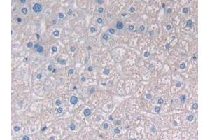 Detection of PAP in Human Liver Tissue using Polyclonal Antibody to Prostatic Acid Phosphatase (PAP) (ACPP antibody  (AA 217-386))