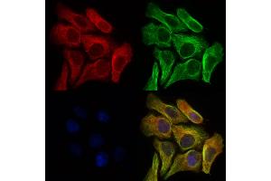 ABIN6254874 and ABIN6276920 staining Hela cells by IF/ICC.