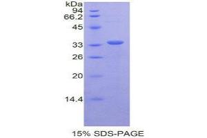 SDS-PAGE (SDS) image for CD163 (CD163) (AA 697-972) protein (His tag) (ABIN2124351)