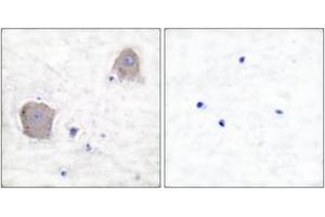 Immunohistochemistry analysis of paraffin-embedded human brain tissue, using mGluR4 Antibody. (Metabotropic Glutamate Receptor 4 antibody  (AA 851-900))