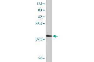 Western Blot detection against Immunogen (36. (GALK1 antibody  (AA 181-279))