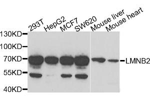 Western blot analysis of extracts of various cell lines, using LMNB2 antibody (ABIN5973877) at 1/1000 dilution. (Lamin B2 antibody)