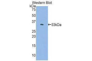 Western Blotting (WB) image for anti-FK506 Binding Protein 10, 65 KDa (FKBP10) (AA 158-440) antibody (ABIN1858892) (FKBP10 antibody  (AA 158-440))