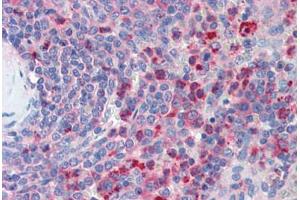 Human Spleen (formalin-fixed, paraffin-embedded) stained with CXCR4 antibody ABIN461996 at 5 ug/ml followed by biotinylated anti-goat IgG secondary antibody ABIN481715, alkaline phosphatase-streptavidin and chromogen. (CXCR4 antibody  (AA 14-40))
