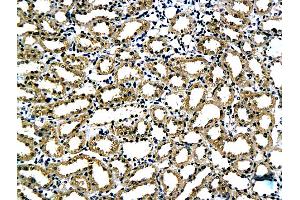 Formalin-fixed and paraffin embedded rat kidney tissue labeled with Anti-Laminin alpha 5 Polyclonal Antibody, Unconjugated (ABIN737451) followed by conjugation to the secondary antibody and DAB staining