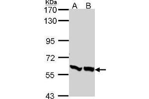 WB Image Sample (30 ug of whole cell lysate) A: A431 , B: H1299 7. (PFKFB3 antibody  (C-Term))