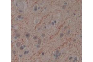 IHC-P analysis of Human Tissue, with DAB staining. (TWF1 antibody  (AA 1-252))