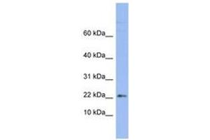 Image no. 1 for anti-Ribosomal Protein S24 (RPS24) (AA 71-120) antibody (ABIN6742964) (RPS24 antibody  (AA 71-120))