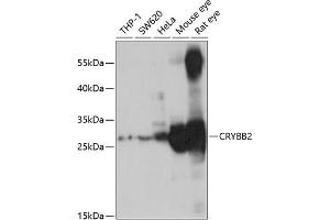 Western blot analysis of extracts of various cell lines, using CRYBB2 antibody (ABIN6130971, ABIN6139077, ABIN6139078 and ABIN6221220) at 1:1000 dilution. (CRYbB2 antibody  (AA 1-205))