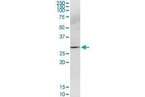 HOXB9 MaxPab rabbit polyclonal antibody. (HOXB9 antibody  (AA 1-250))
