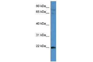 WB Suggested Anti-MAP3K15 Antibody Titration:  0.