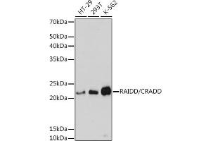 Western blot analysis of extracts of various cell lines, using RAIDD/CRADD Rabbit mAb (ABIN7266106) at 1:3000 dilution. (CRADD antibody)
