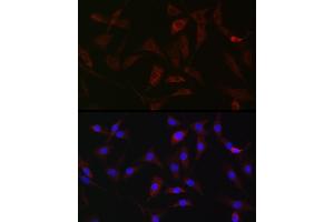 Immunofluorescence analysis of NIH/3T3 cells using [KO Validated] HK1 Rabbit pAb (ABIN3021308, ABIN3021309, ABIN3021310 and ABIN6214823) at dilution of 1:50 (40x lens). (Hexokinase 1 antibody  (AA 20-300))