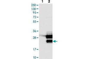 Western blot analysis of Lane 1: Negative control (vector only transfected HEK293T lysate). (TCF21 antibody)