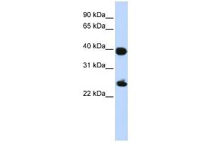 H2AFY antibody used at 1 ug/ml to detect target protein.