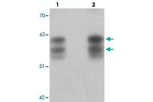 Western blot analysis of NSRP1 in human brain tissue with NSRP1 polyclonal antibody  at (lane 1) 0. (NSRP1 antibody  (C-Term))