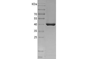 Western Blotting (WB) image for Plasminogen Activator Inhibitor 1 (SERPINE1) (AA 24-402) protein (His tag) (ABIN7281661) (PAI1 Protein (AA 24-402) (His tag))