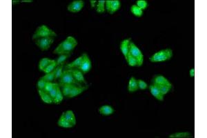 Immunofluorescence staining of HepG2 cells with ABIN7157138 at 1:66, counter-stained with DAPI. (IST1 antibody  (AA 172-284))