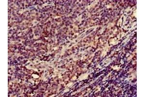 Immunohistochemistry of paraffin-embedded human lymph node tissue using ABIN7156481 at dilution of 1:100 (Integrin beta 2 antibody  (AA 37-201))