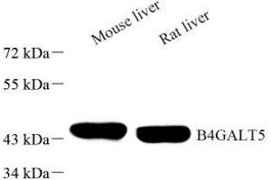 Western blot analysis of B4GALT5 (ABIN7076138) at dilution of 1: 1000