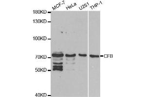 Western blot analysis of extracts of various cell lines, using CFB antibody.