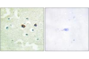 Immunohistochemistry analysis of paraffin-embedded human brain, using PTP1B (Phospho-Ser50) Antibody. (PTPN1 antibody  (pSer50))