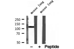 Western blot analysis of extracts of mouse lung tissue, using OGDH antibody.